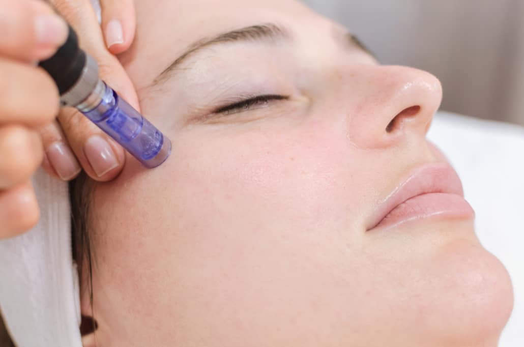 میکرونیدلینگ برای رفع چین و چروک و جای اسکار