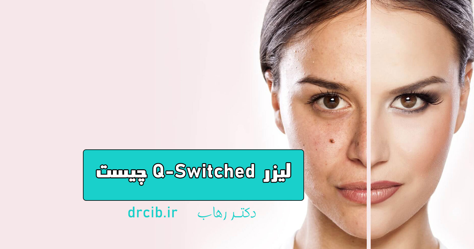 QSwitch-dr-rahab-دکتر رهاب-کیوسوییچ