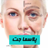 همه-چیز-درباره-پلاسماجت-و-عملکرد-آن-روی-سطح-پوست-دکتر رهاب