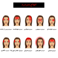 انواع سردرد دکتر سیب