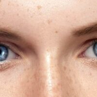 راهکارهایی برای کاهش لکه‌های پیری پوست