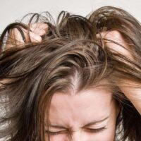 رفع چربی مو - دکتر سیب دکتر رهاب