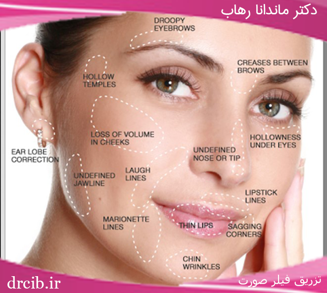 دکتر-رهاب-دکتر-سیب--تزریق-ژل