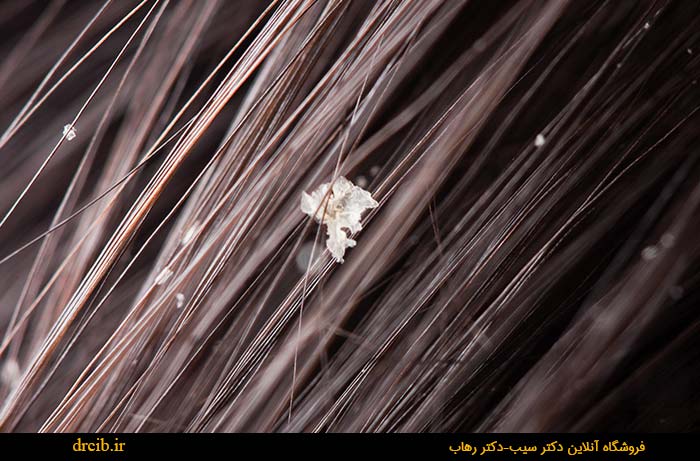 شامپو-ضد-شوره-دکتر-رهاب
