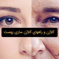 کلاژن-سازی-دکتر-رهاب