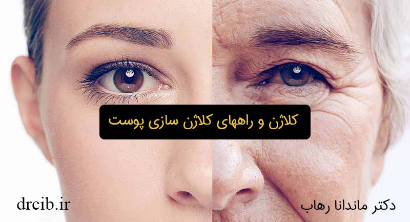 کلاژن-سازی-دکتر-رهاب