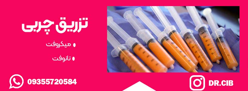 تزریق چربی به صورت