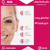 فوتونا | جوانسازی 4 بعدی | لیزر صورت