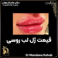قیمت ژل لب روسی