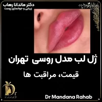 ژل لب مدل روسی تهران قیمت، مراقبت ها