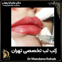 ژلب لب تخصصی تهران